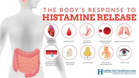 Histamin intolerance